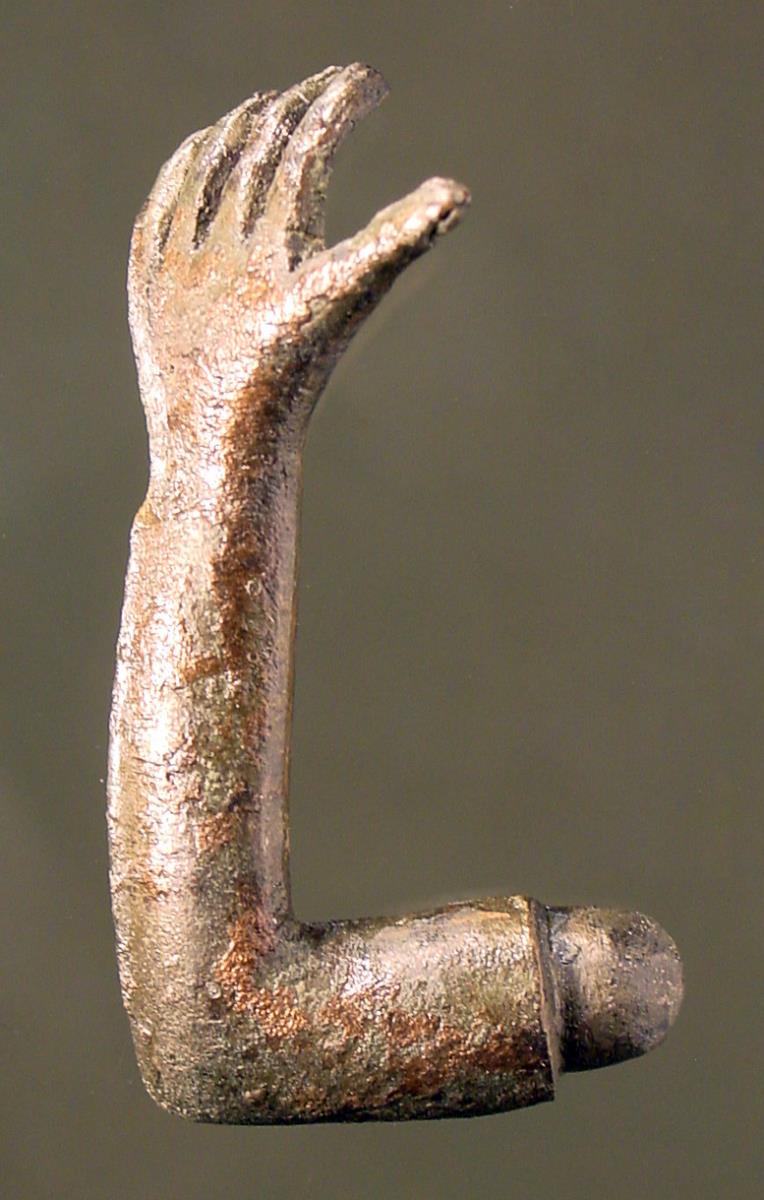 "Linker Arm, im Ellenbogen gebogen"