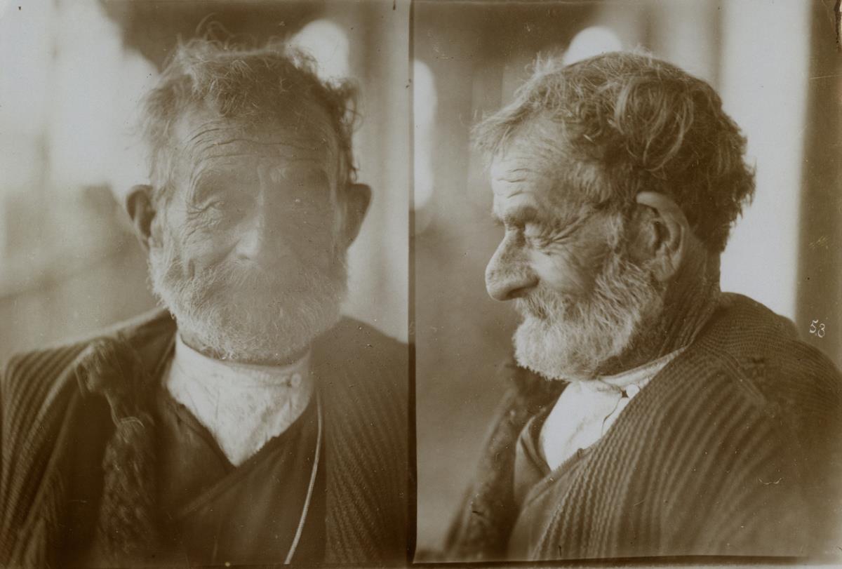 Kopf eines Türken. a: von vorn; b: im Profil