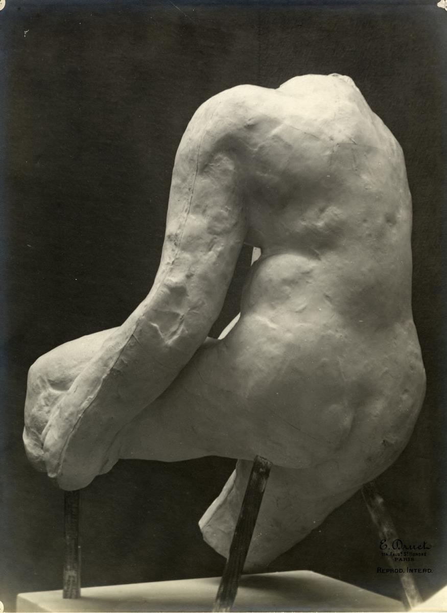 Weiblicher Torso, genannt Torso Morhardt