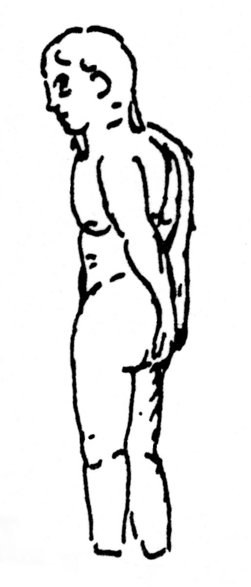 Rachepuppe. Junge männliche nackte Figur. Hände auf den Rücken. Körper mit eingeritzten Namen bedeckt. Eine Hälfte abgeschmolzen, Füße weggebrochen